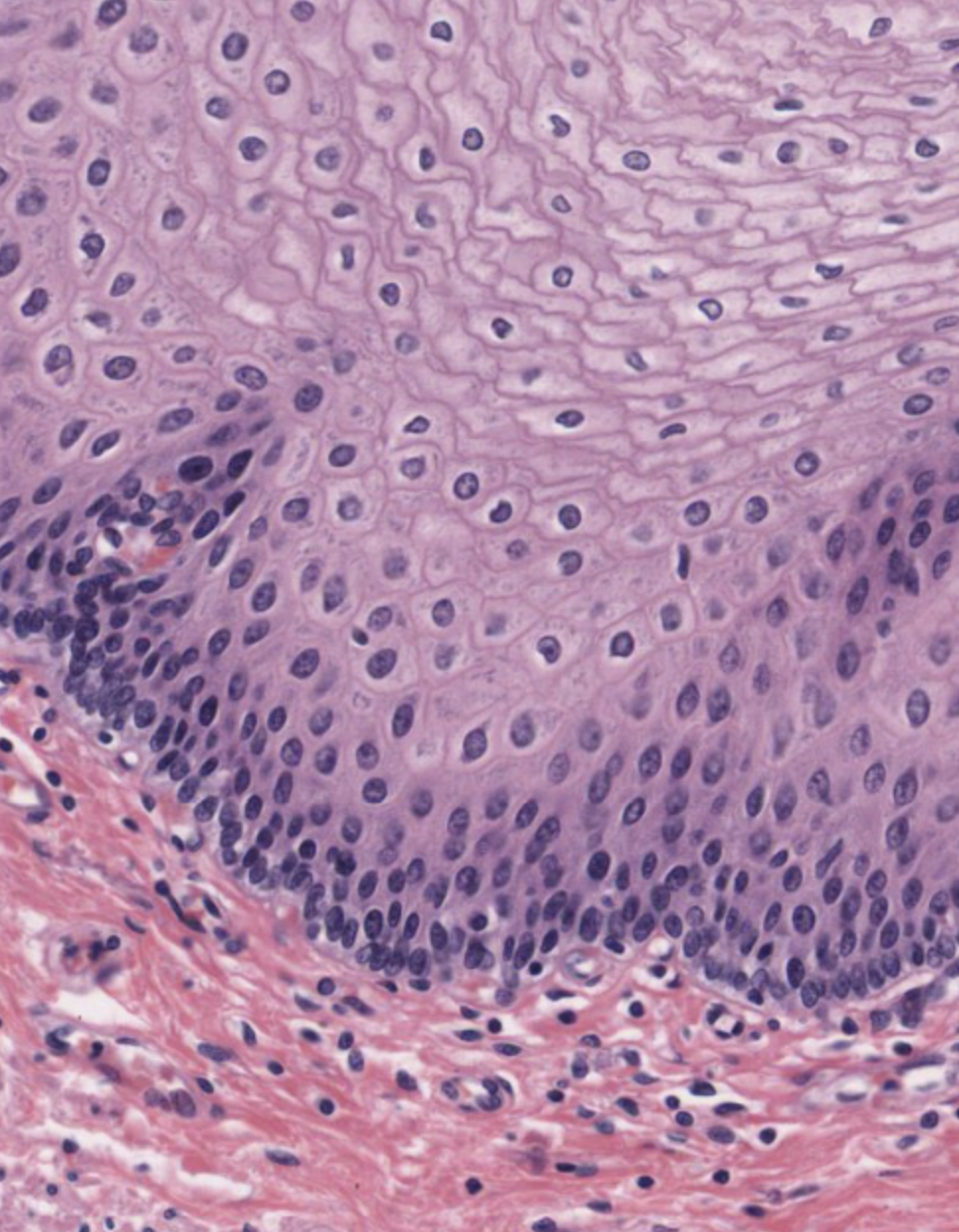 <p>Epithelial tissue that has multiple layers of cells becoming flattened as they move from the basal layer to the apical layers. It provides protection from abrasion and is keratinized on the external surface of the body. (Can be keratinized or non-keratinized)</p>