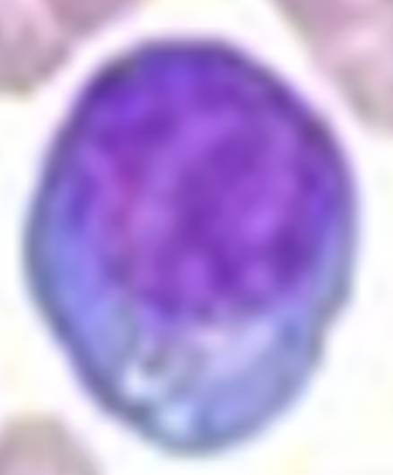 <p><span style="color: purple;"><strong><em><span>Formed Element:</span></em></strong></span> <strong>Lymphocyte (leukocyte)</strong></p>