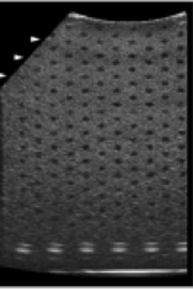 <p>This phantom is used to detect:</p><p>A. Lateral resolution</p><p>B. Axial resolution</p><p>C. Slice thickness</p><p>D. Dead zone</p><p>E. Contrast resolution</p>