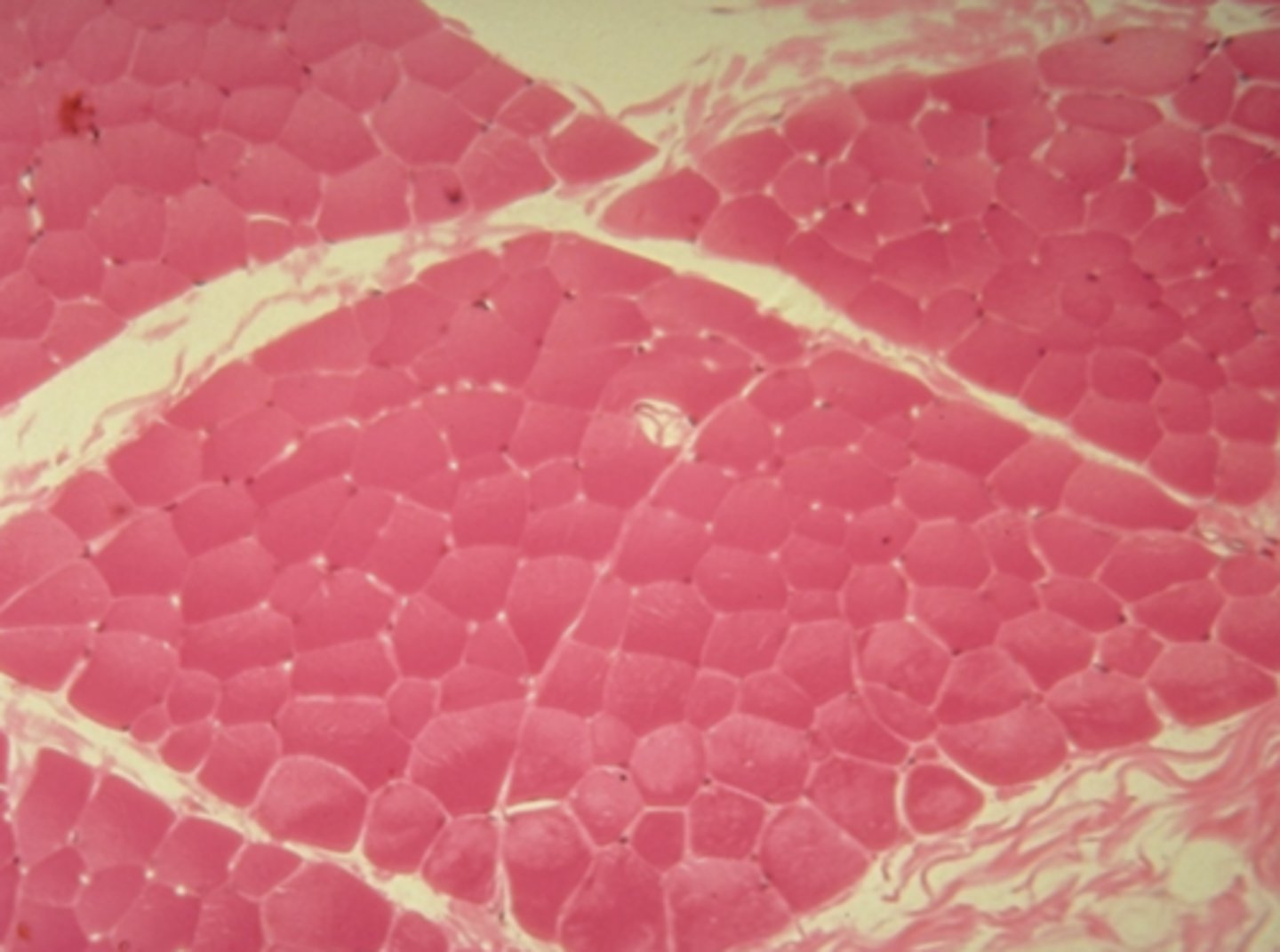 <p>Which of the three muscle tissue types is presented in the following image:</p>
