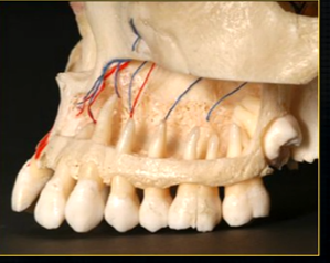 <p>when the thin, surface bone of the maxilla is removed …</p>