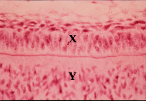 <p>identify X</p>