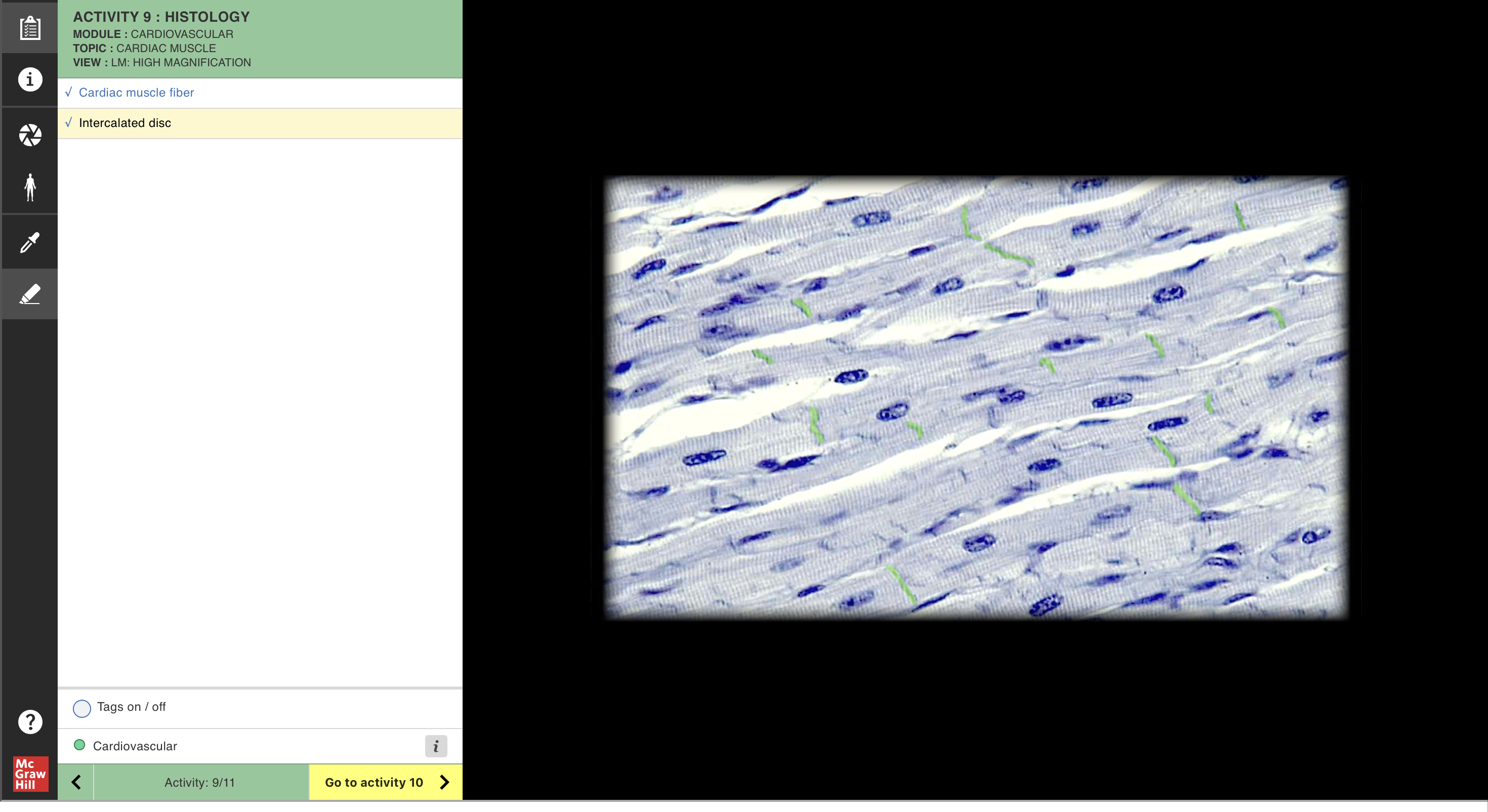 knowt flashcard image