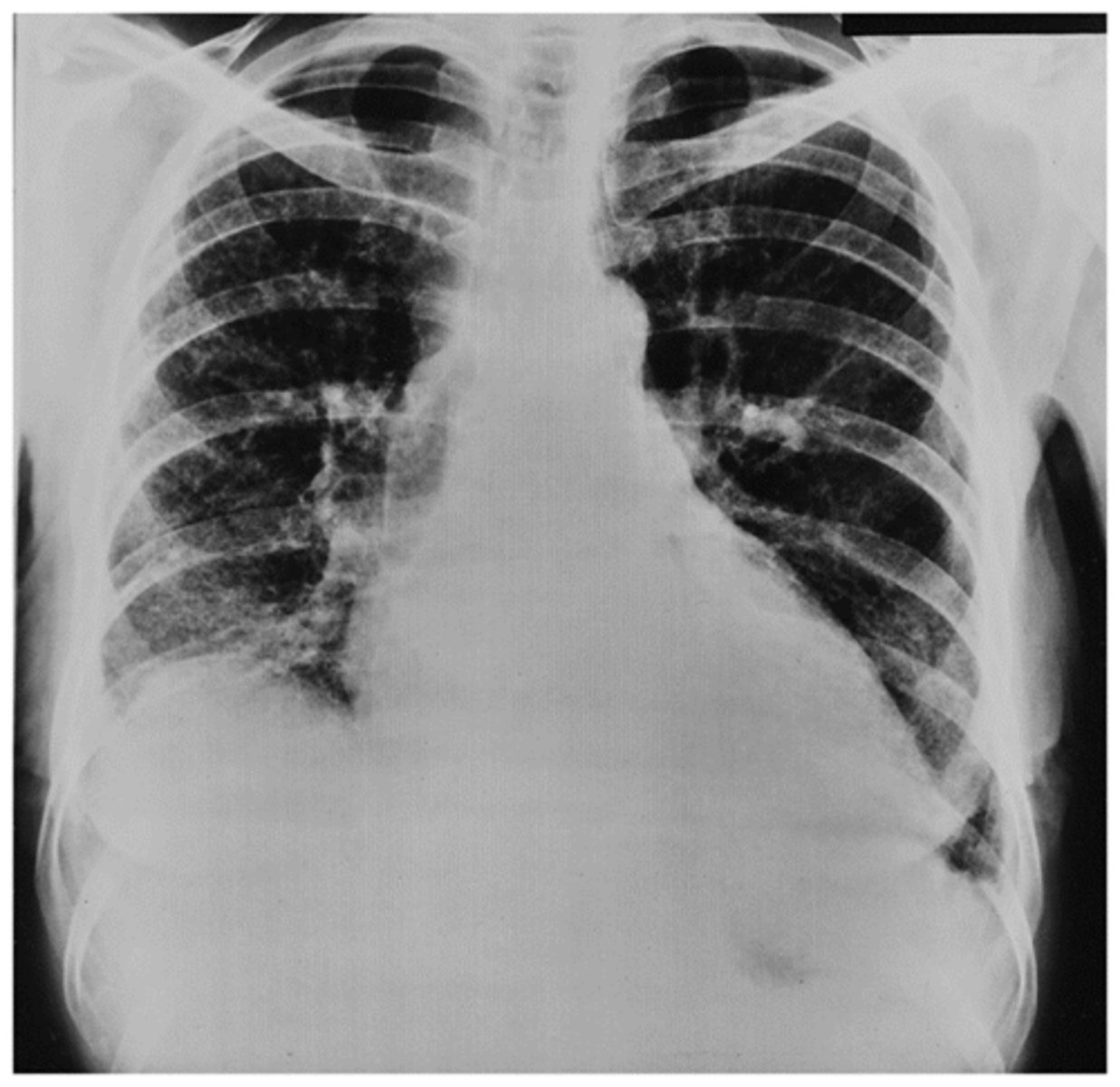 <p>Interpretation?</p>