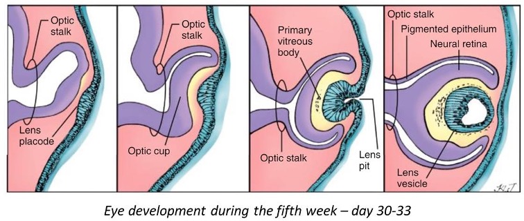 <ol><li><p>optic vesicles form as invagination of lateral diencephalon</p></li><li><p> they invaginate to form the optic cup (gives rise to the neural retina and pigmented retina)</p></li><li><p>invagination of the surface extoderm forms the lens placode, this develops into the lens pit</p></li><li><p>lens pit pinches off and is now enclosed by the optic cup</p></li><li><p>posterior cells of lens vesicle elongate to form long primary fibers, these reach the les vesicle and form the lens.</p></li></ol><p></p>