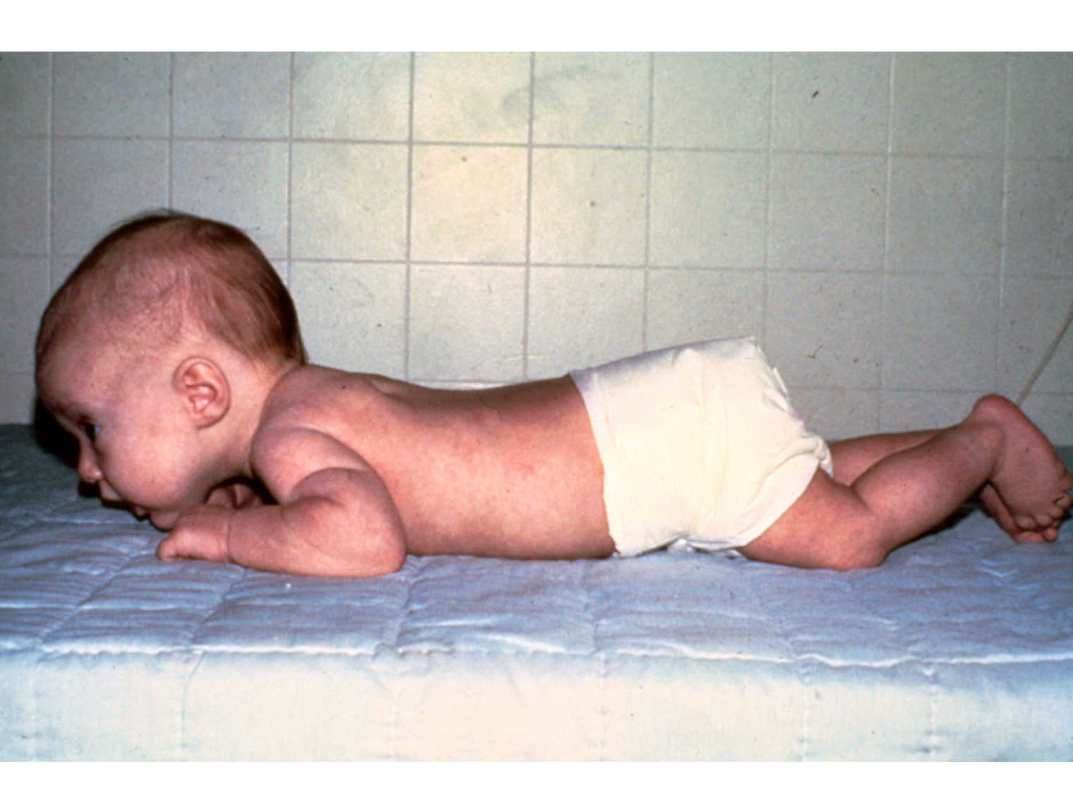 <p>what quarter of life is this infant demonstrating?</p>
