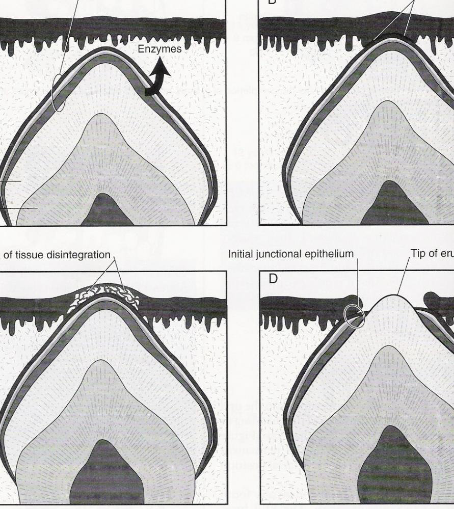 <p>The first epithelial attachment: junctional epithelium</p>