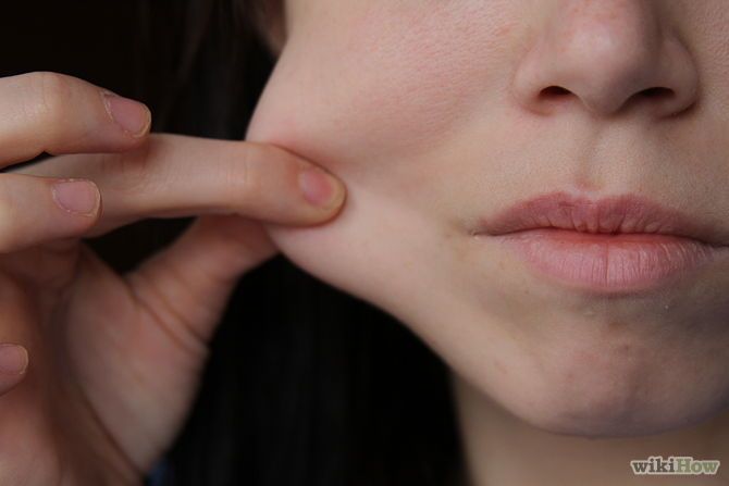 <p>Cheek</p>