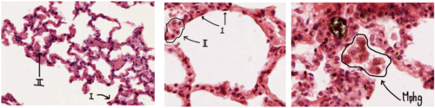 <p>. Type I pneumocytes</p><p>.Type II pneumocytes </p><p>. Brush cells </p><p>. Pulmonary macrophages</p>