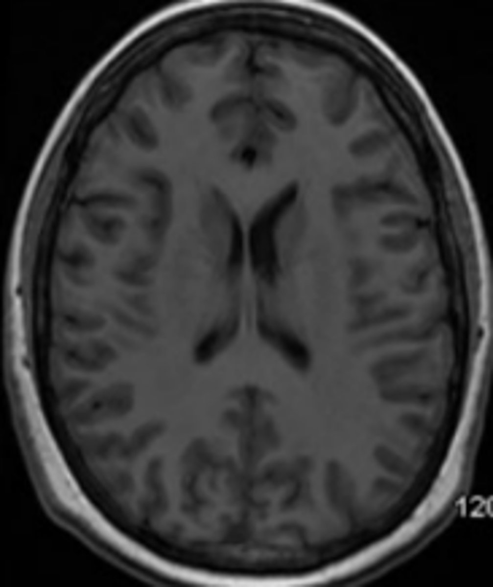 <p>imaging plane that is along the horizontal plane.</p>
