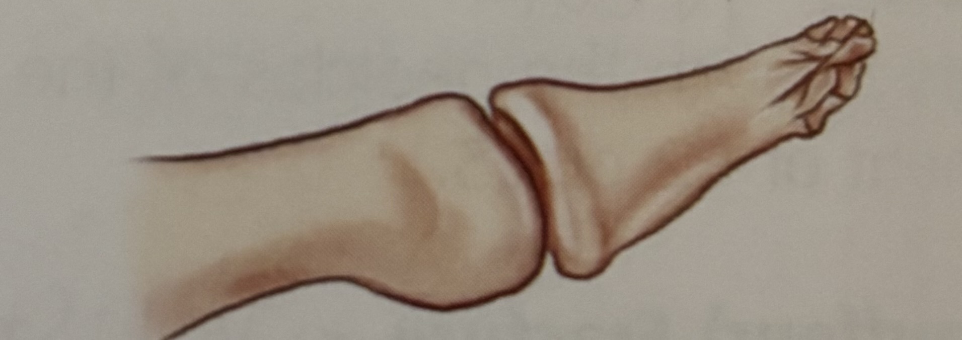 <p>What type of fracture is this?</p>
