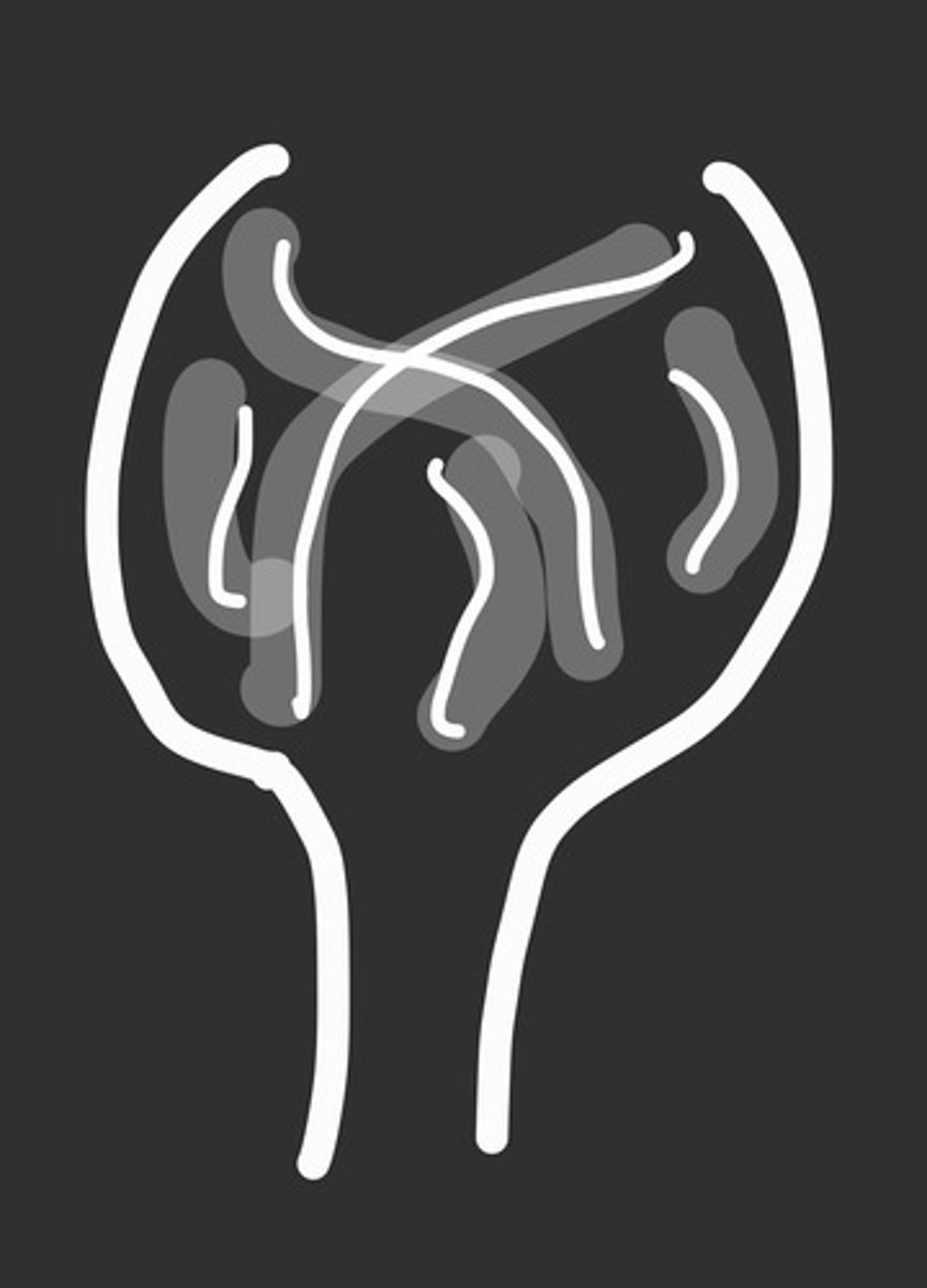<p>patient between ages 5 to 25 and experiencing pain</p><p>what tumour is this?</p>