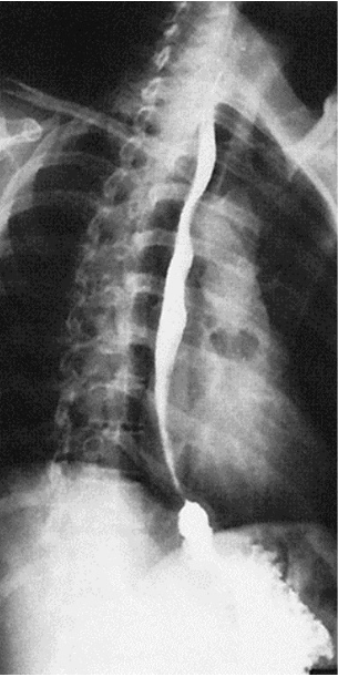 <p><span>What contrast procedure was performed to produce this image?</span></p>