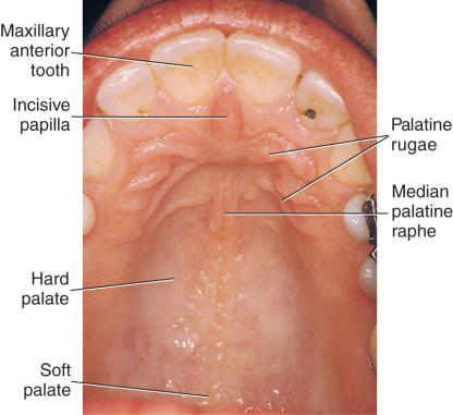 <p>What branch of the Sphenopalatine artery travels through the incisive foramen?</p>