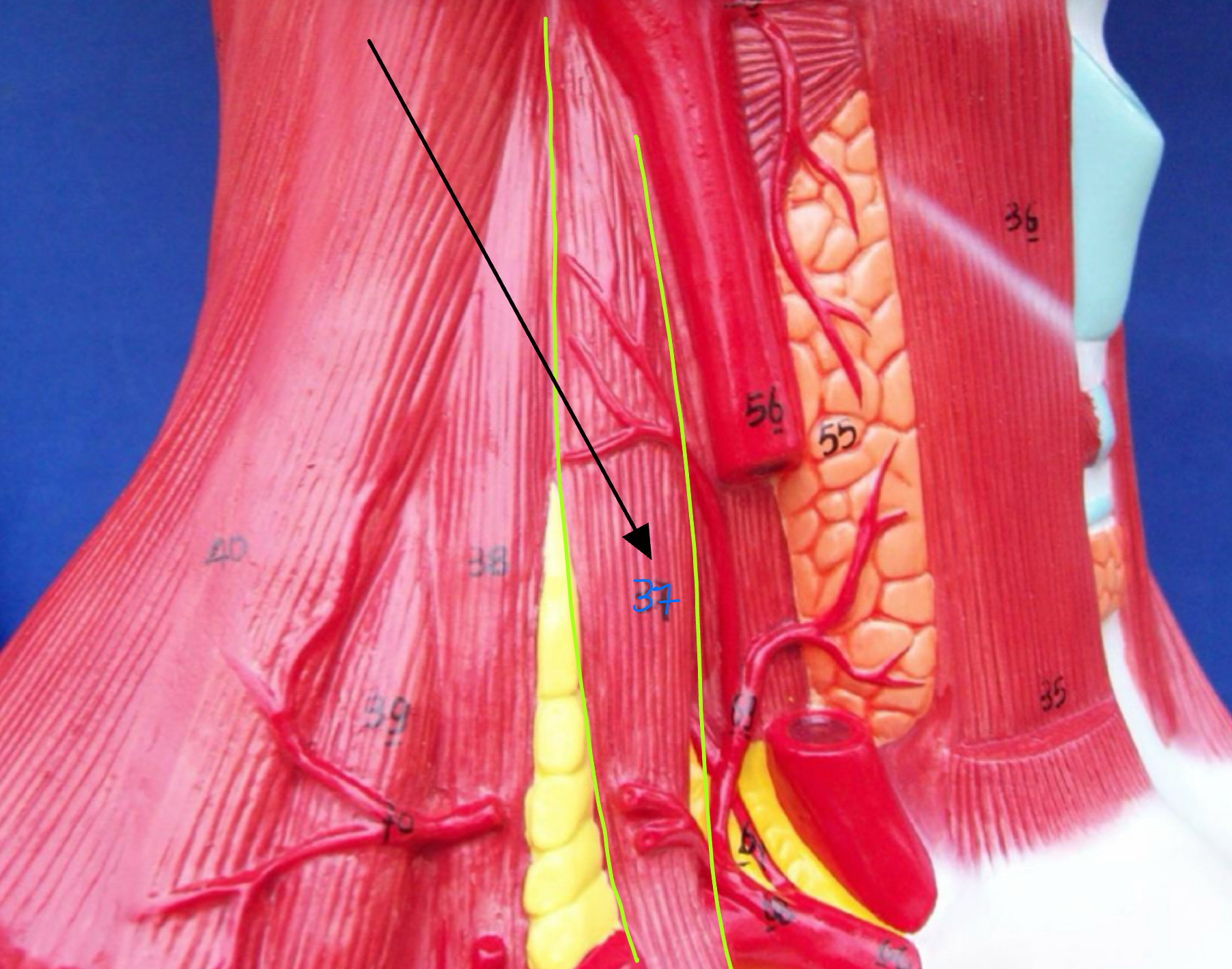 <p>What type of muscle is this ( altay muscle )</p>