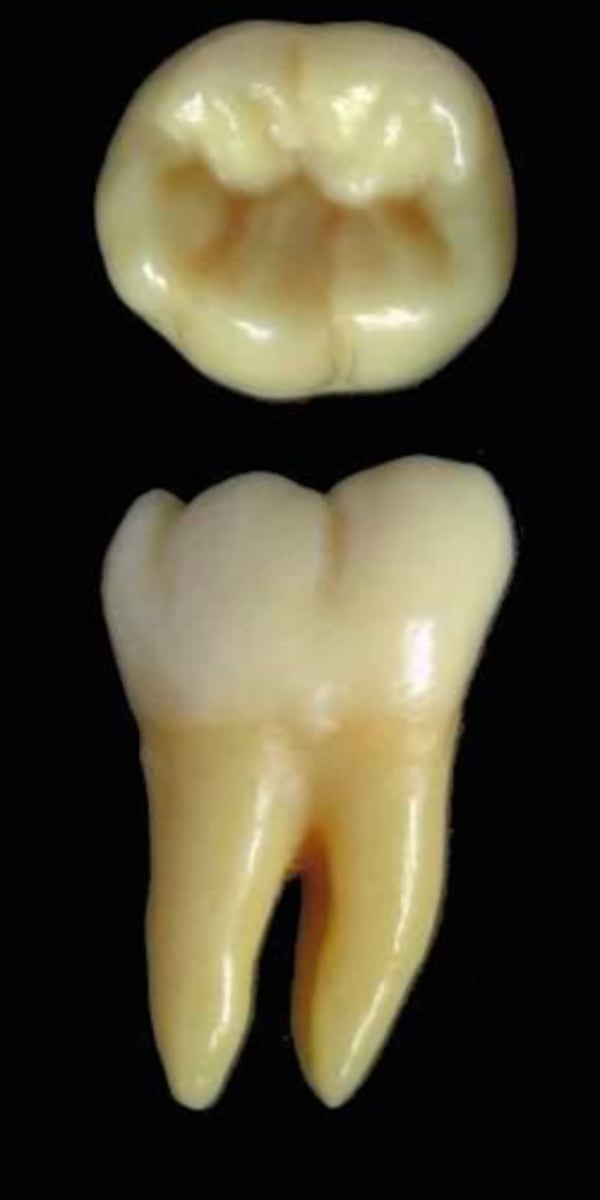 <p>what tooth is this &amp; why?</p>