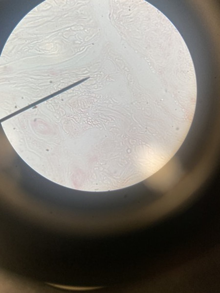 <p>What type of tissue</p>