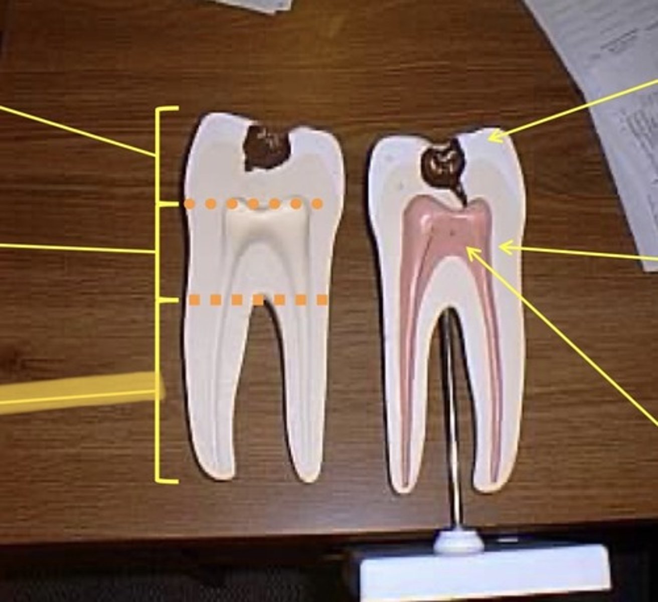knowt flashcard image