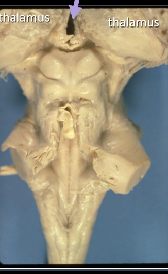 <p>is formed by the third ventricle. </p><p>if you stand inside the third ventricle and put your hands out you will touch thalamus on both sides </p>