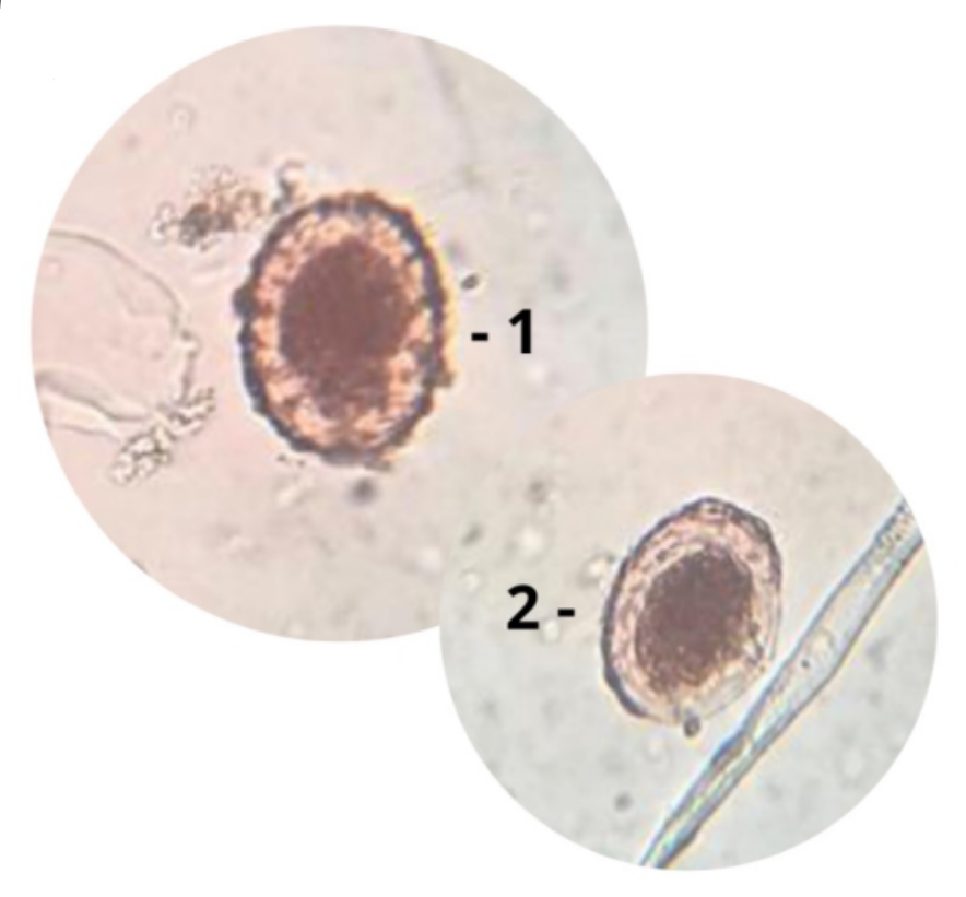 <p>Sobre o(s) ovo(s) na foto, escreva:</p><ul><li><p><strong>NOME CIENTÍFICO</strong> da espécie de parasito</p></li><li><p><strong>FORMA EVOLUTIVA</strong> (+ <strong>SEXO</strong> - <u>se houver</u>)</p></li></ul>