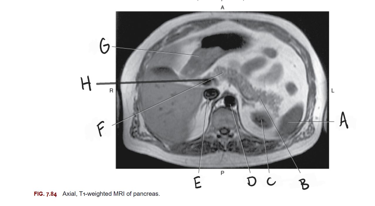 <p>What is F</p>