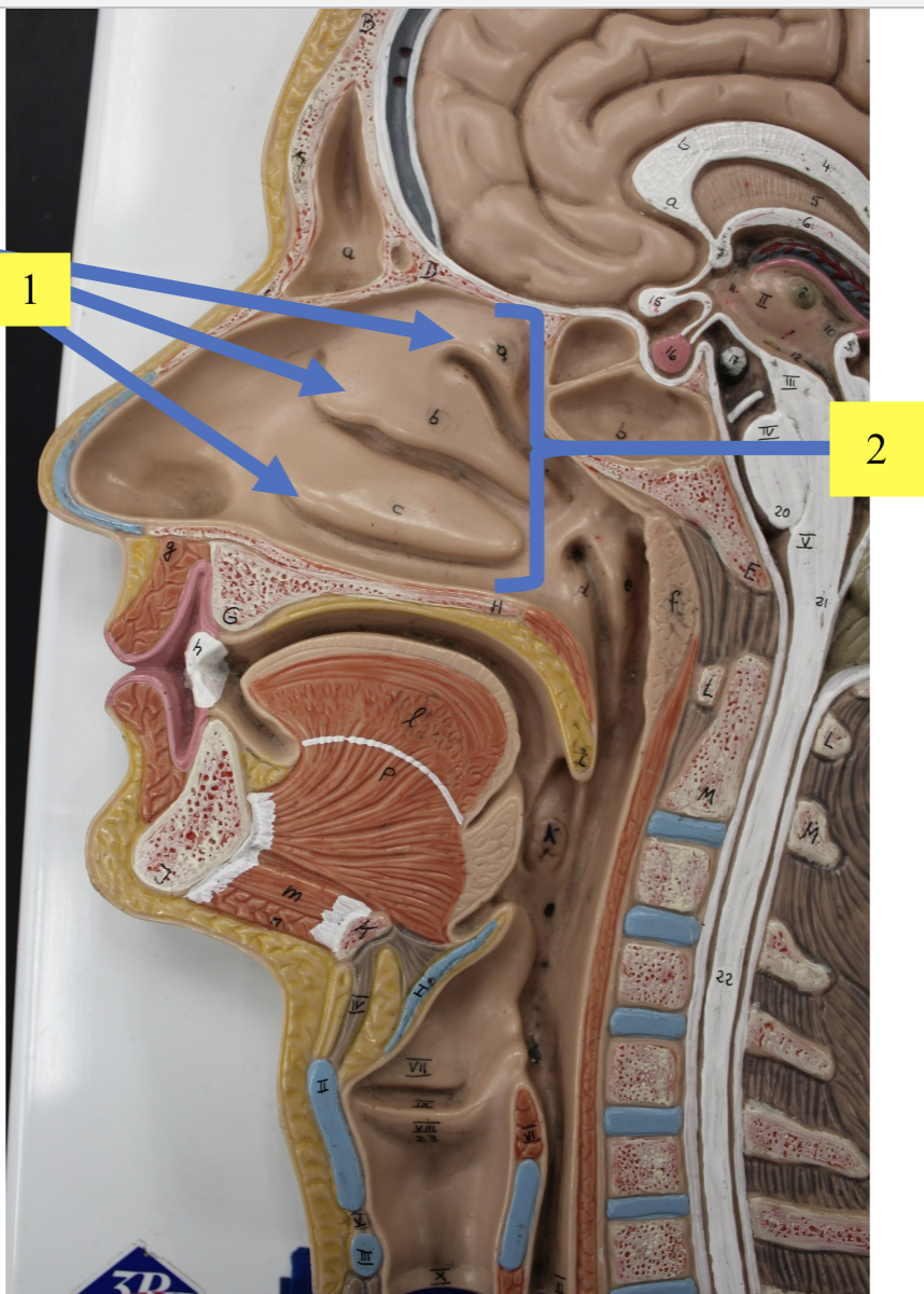 <p>structure 1 </p>
