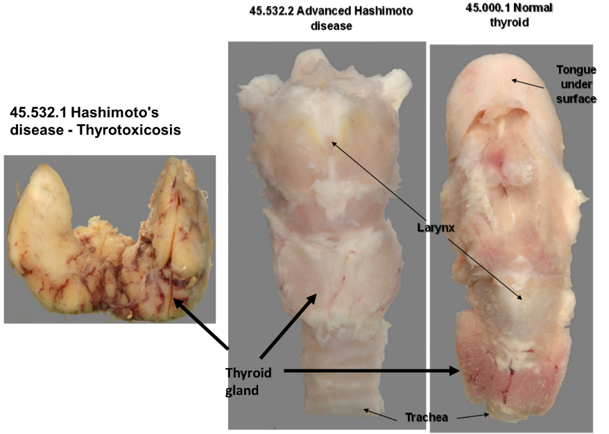 <p>Are there any areas of obvious or specific abnormality?</p>