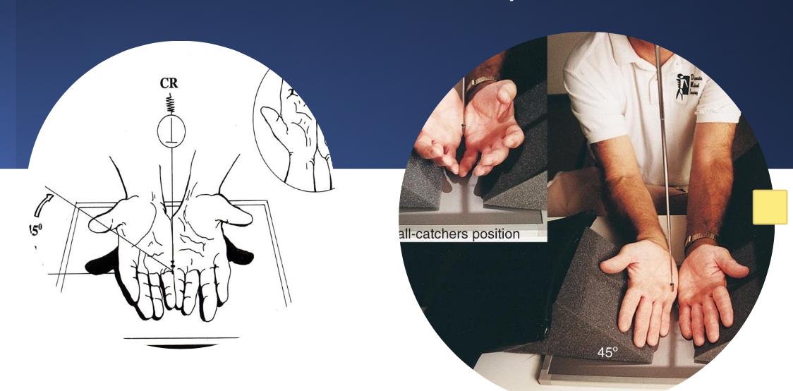 <p>ball catcher (AP oblique)</p>