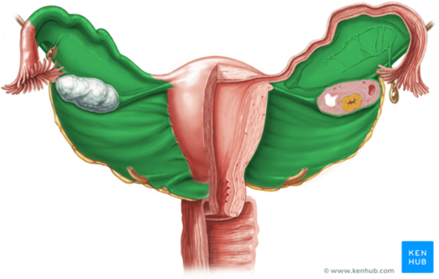 <p>runs parallel to the uterine horns and holds uterus in place</p>