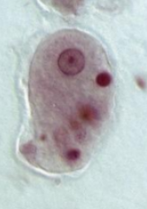 <p>(Tổng hơp 4) Biện pháp nào sau đây có thể góp phần dự phòng bệnh do ký sinh trùng này (Hình) gây ra?</p>
<p>A. Không ăn cá sống<br />
B. Mang ủng khi tiếp xúc đất<br />
C. Kiểm dịch chặt chẽ các lò mổ<br />
D. Diệt ruồi, gián</p>