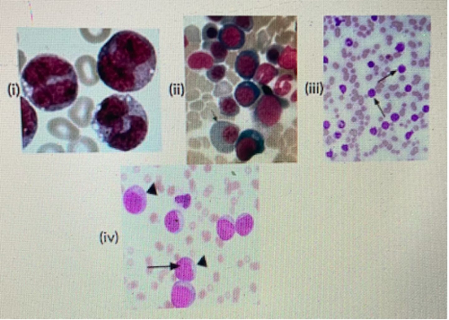 <p>Which of the photos in plate 4 best indicates a cat-specific leukaemia?</p>
