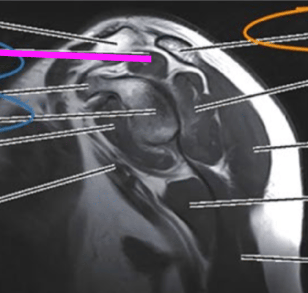 <p>what does the pink line point to?</p>