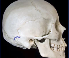 <p>Right Lateral View</p>