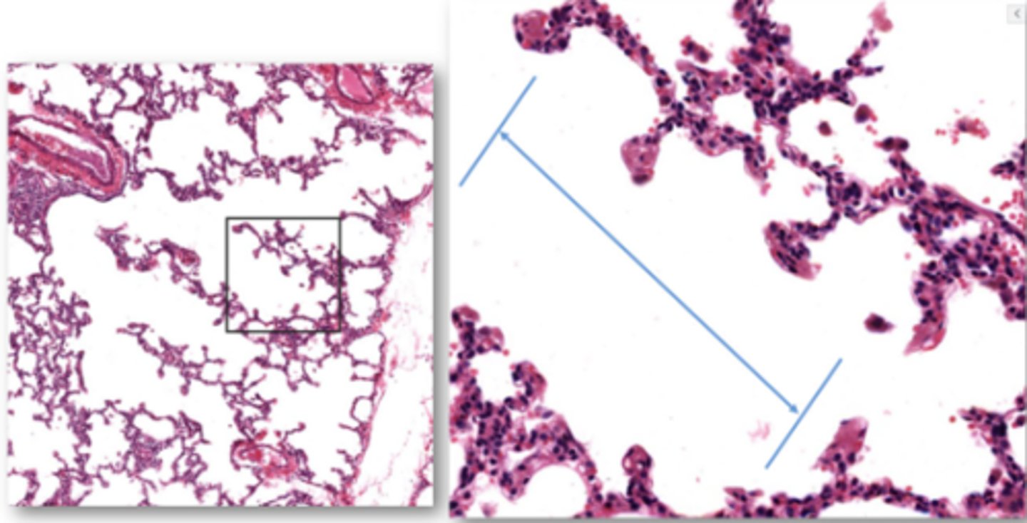 <p>Identify the airway segment between the lines.</p>