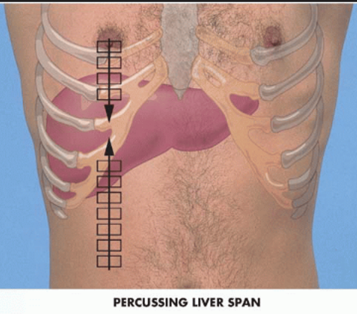 <p>D</p><p>A liver span of 10.5 cm is the mean for males and 7 cm for females. Men and taller individuals are at the upper end of this range. Women and shorter individuals are at the lower end of this range. A liver span of 11 cm is within normal limits for this individual.</p>