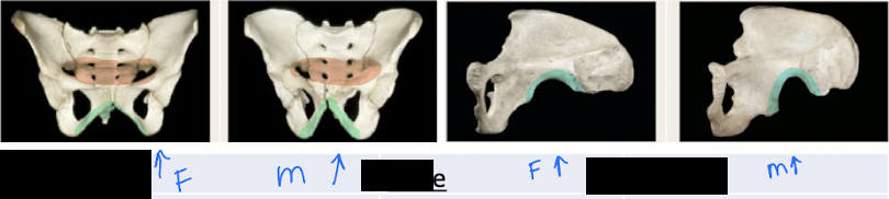 <p>Male</p><ul><li><p>Pelvic inlet is heart shaped (red)</p></li><li><p>Pubic arch and Subpubic angle is less than 80 degrees (green)</p></li><li><p>greater sciatic notch is narrow (blue)</p></li></ul><p>Female</p><ul><li><p>pelvic inlet is wide oval (red)</p></li><li><p>Pubic arch and subpubic angle is greater than 90 degrees (green) </p></li><li><p>greater sciatic notch is wide (blue)</p></li></ul><p></p>