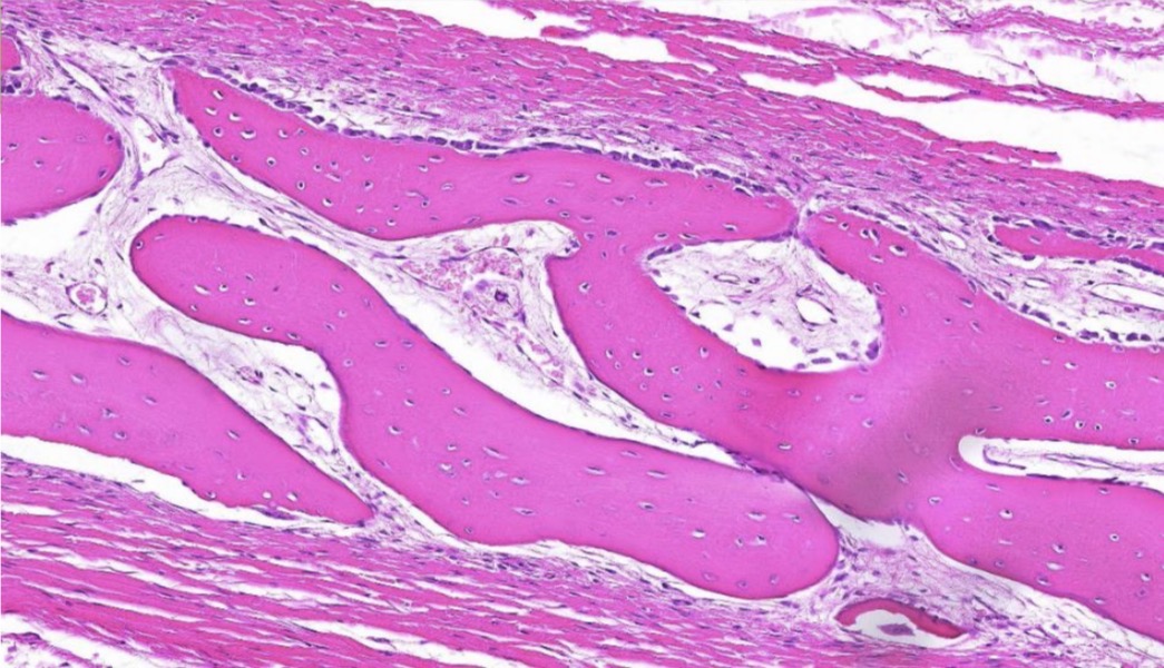 <p>Osificaci贸n intramembranosa </p>