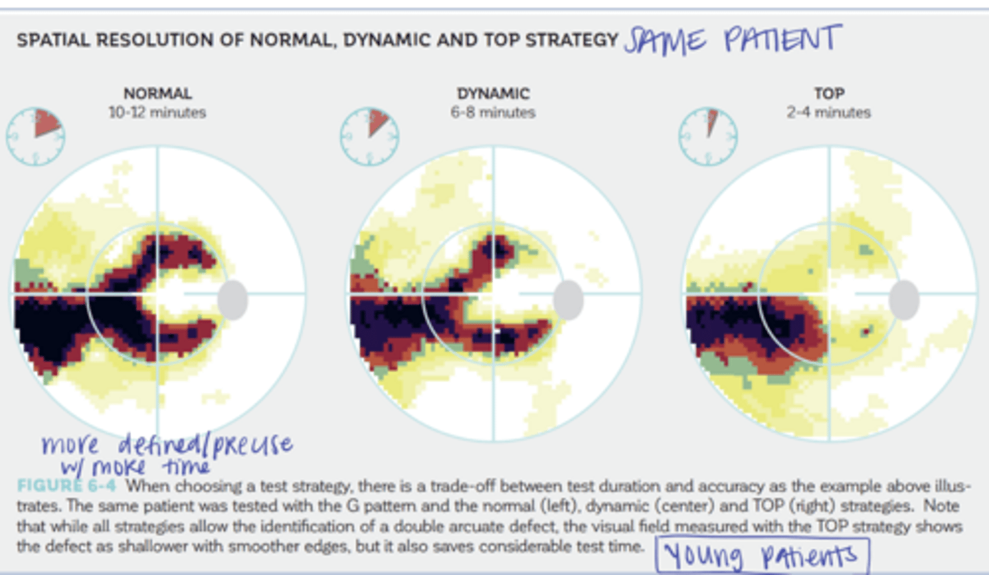<p>Spatial Resolution -- SITA Standard, Fast, Faster (Pic)</p>