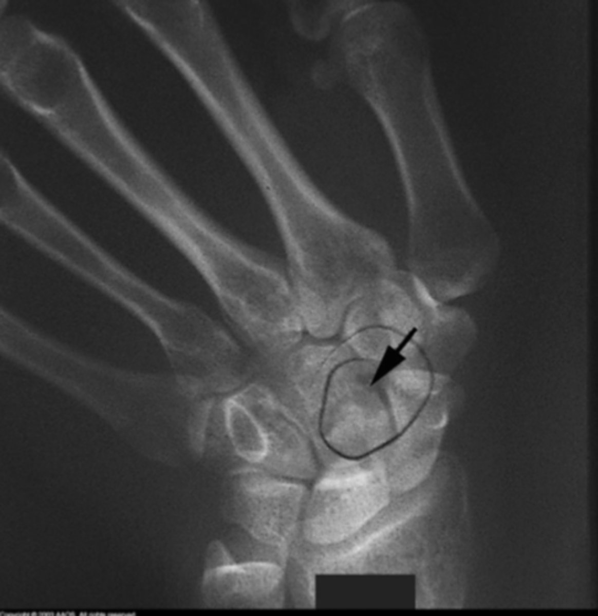 <p>What is the issue?</p>