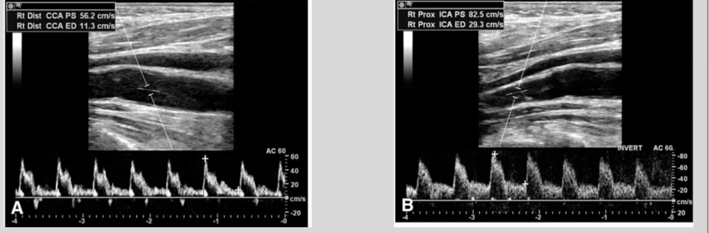 <p>what is this waveform showing?</p>