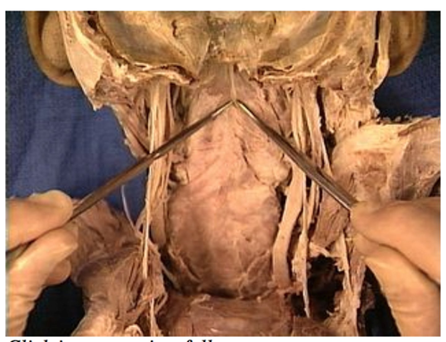 <p><em>identify the structure:</em></p>