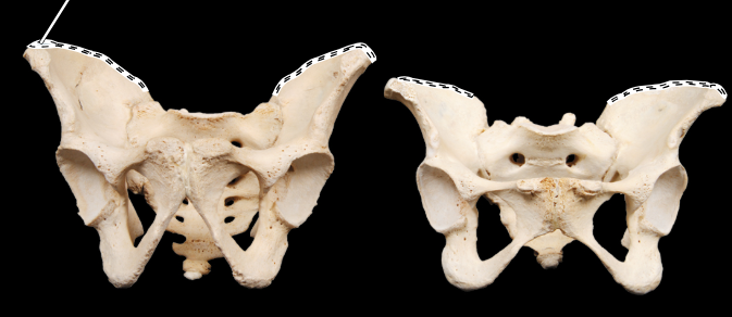 <p>Articulated male (at left) and female (at right) pelves, anterior view</p>