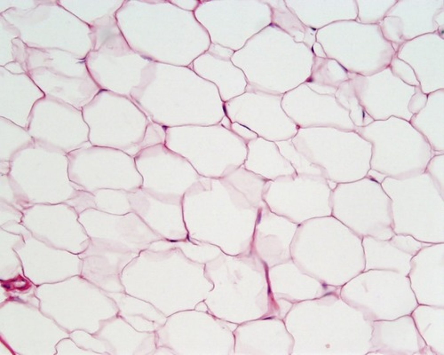 <p>subcutaneous fat beneath skin</p><p>breast</p><p>heart surface</p><p>mesenteries</p><p>surrounds organs such as kidneys &amp; eyes</p>