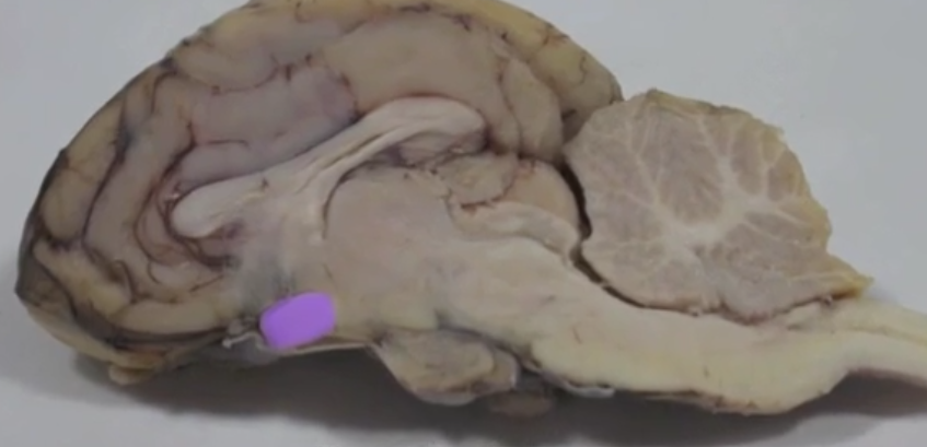 <p>Optic chiasm </p>