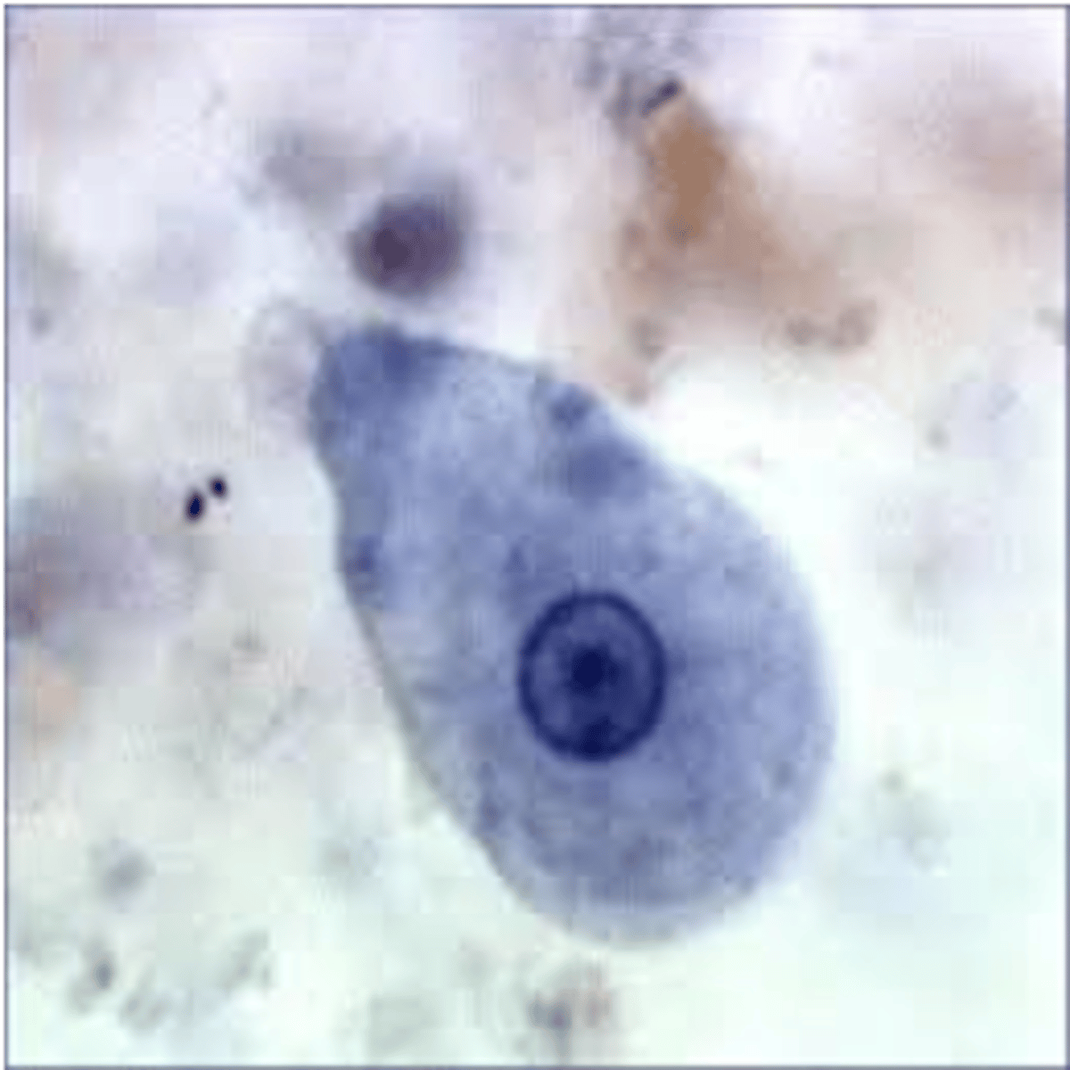 <p>amorphous (no definite shape), and may have pseudopodia (rare, less numerous), debris in background due to being found in stool</p>