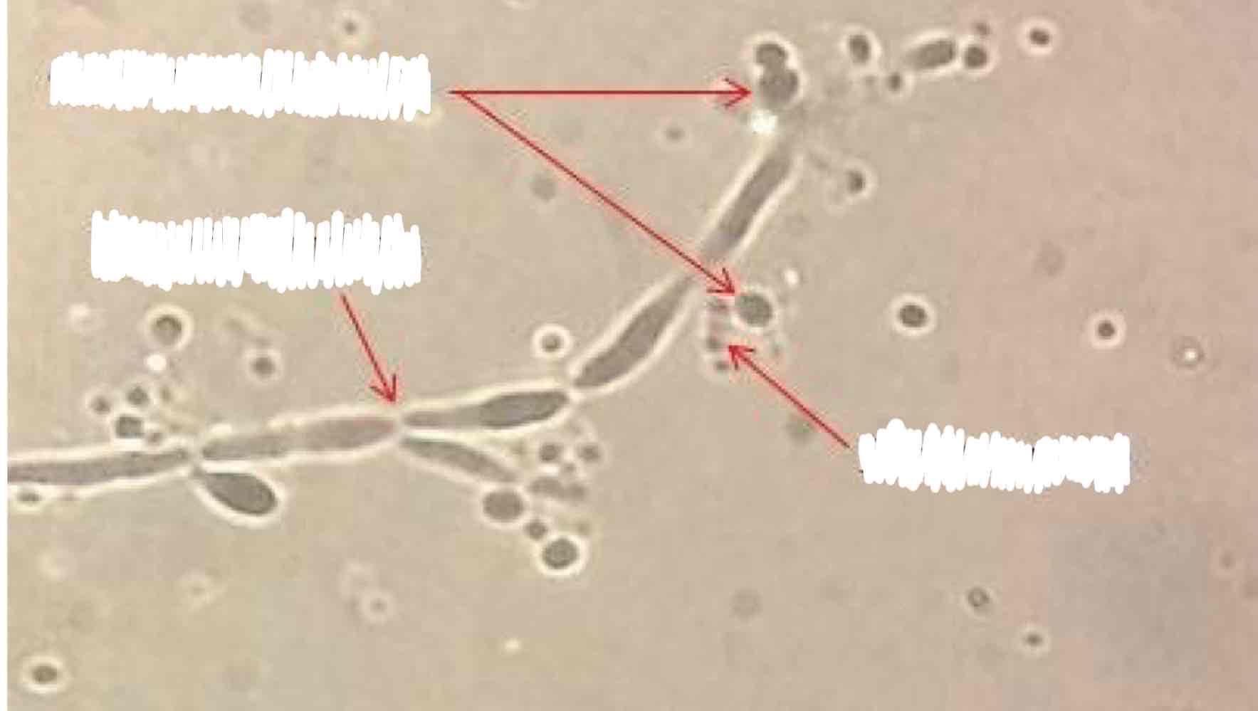 <p><span>Name the spore and its structures:</span></p>