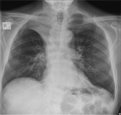 <p>What is this pathology?</p>