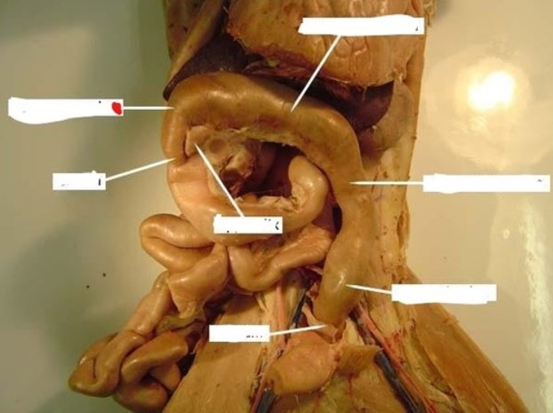 <p>What portion of the large intestine is indicated by the red dot?</p>