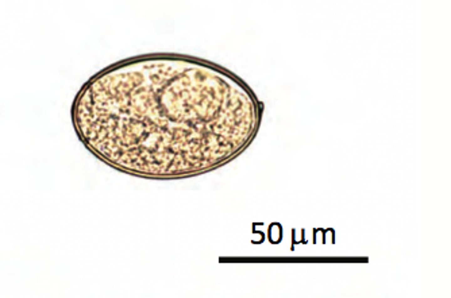 <p>This operculated "fish tapeworm" (cesatode) egg can be recovered from fecal specimens if pickled or raw freshwater fish are ingested. Which ovum is present?</p>