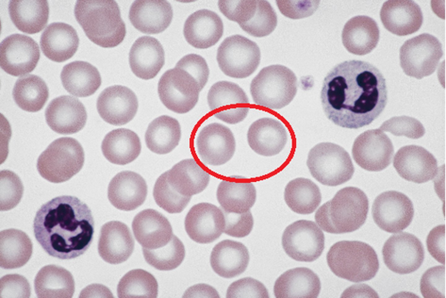 <p>Red blood cells</p>